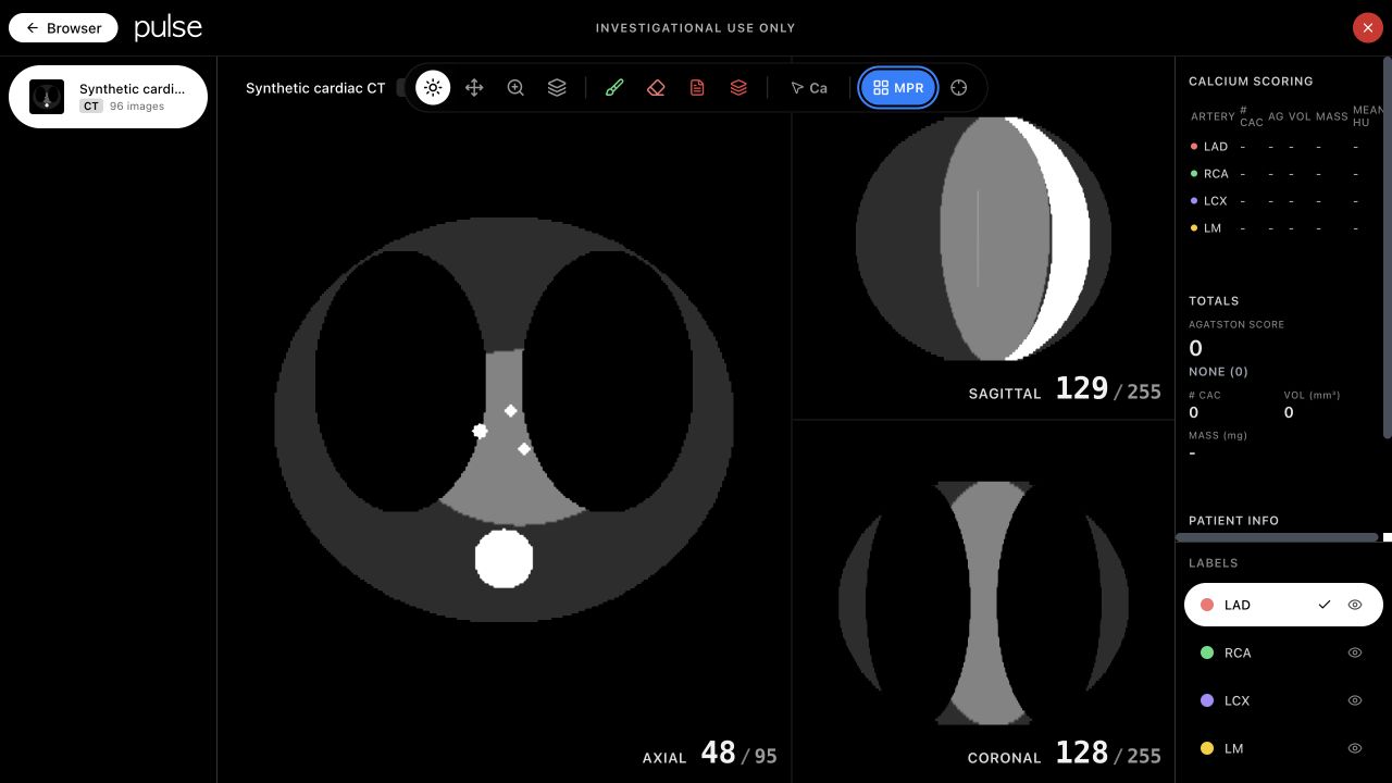 PulseImaging desktop viewer rendering a generated, non-clinical CT volume in axial, sagittal, and coronal planes